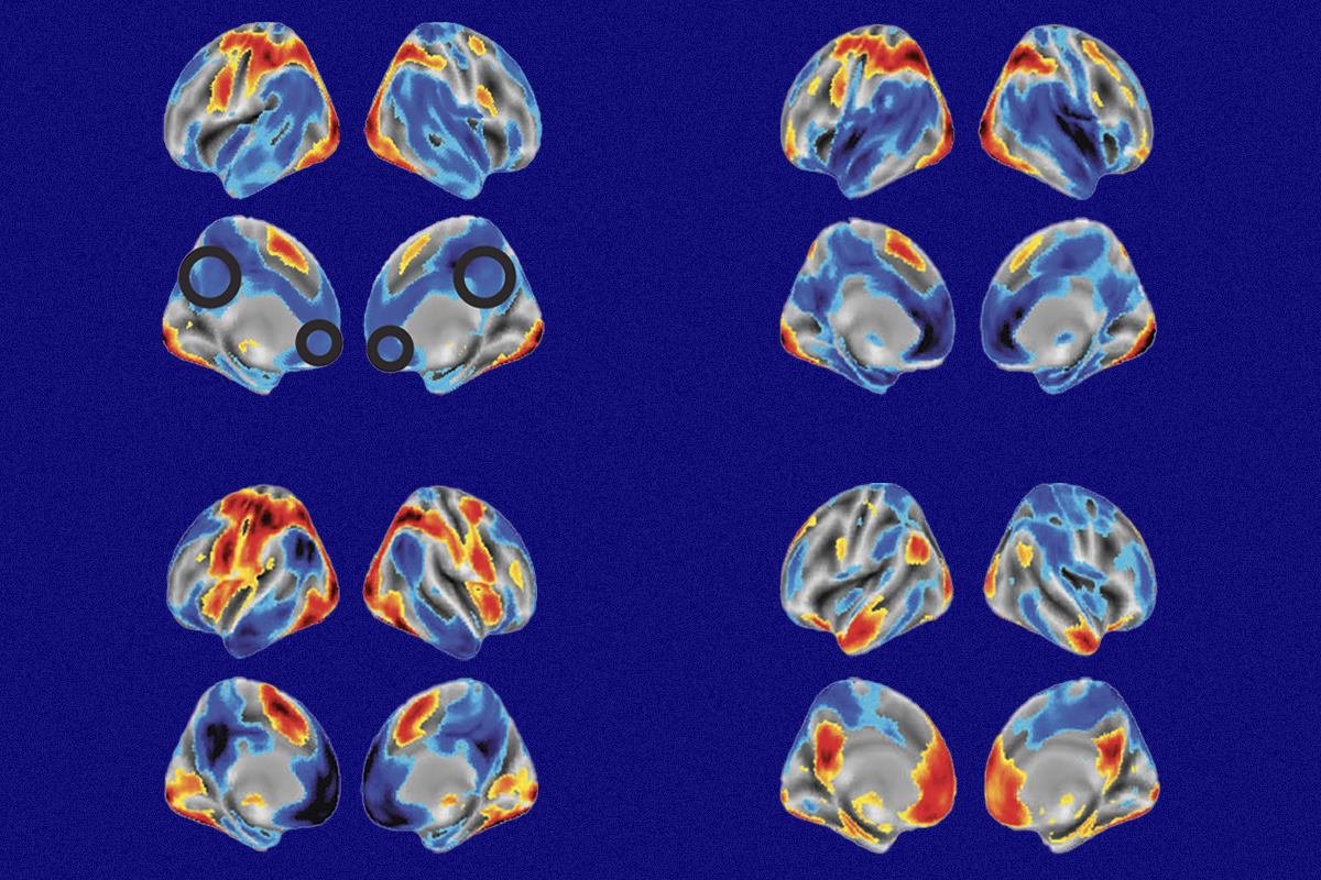Research image of fMRI scans showing decision-making across individuals.
