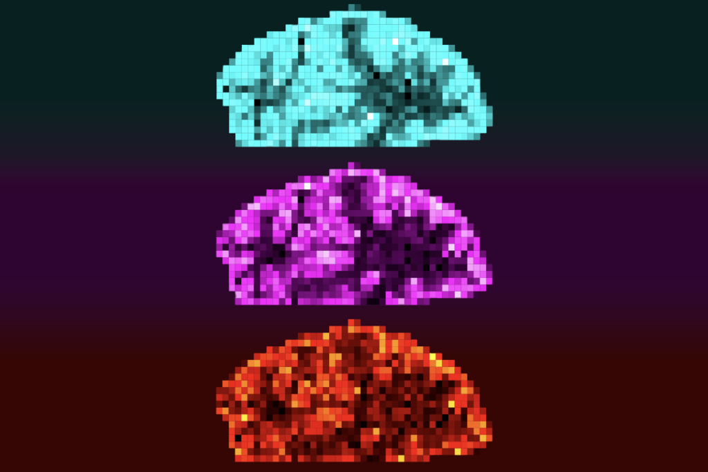 Pixelated human brain scans showing the distribution of mitochondria.
