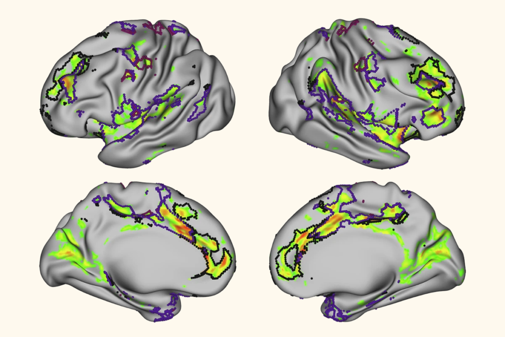 Research image showing resting-state functional connectivity in the human red nucleus.