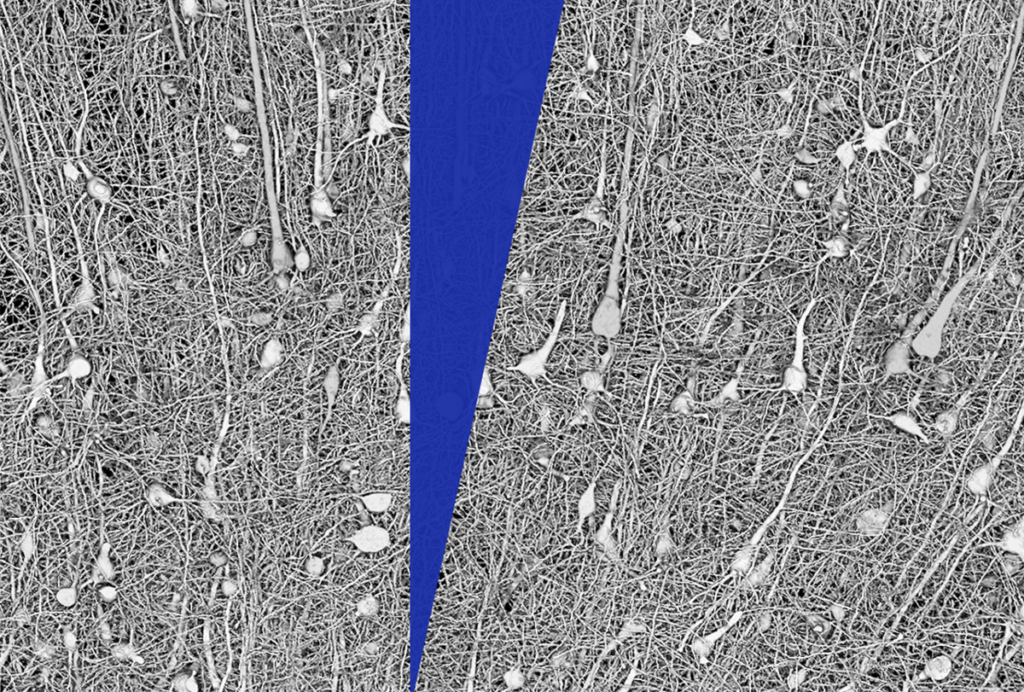 Image of a connectome being split into two.